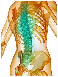 Spondylitis Treatment in Pune