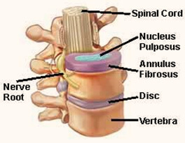 Spondylitis Treatment in Pune